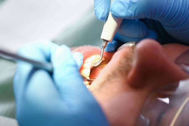 Best Emergency Dental Care for Trauma or Injury in Strawberry, CA