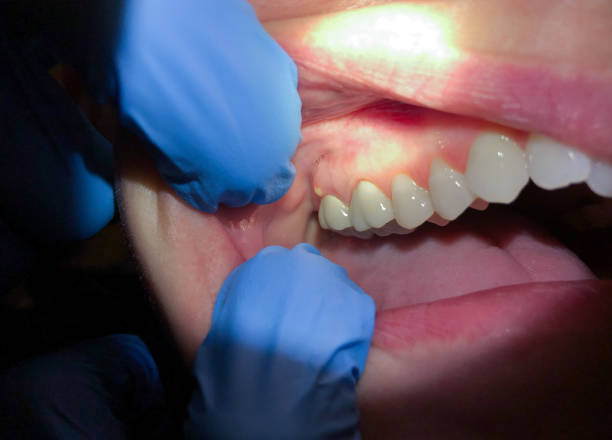 Best Weekend Emergency Dentist in Strawberry, CA