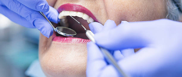 Best Emergency Wisdom Teeth Removal in Strawberry, CA